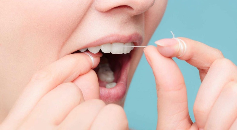 Những điều cần biết khi niềng răng ở trẻ em 2