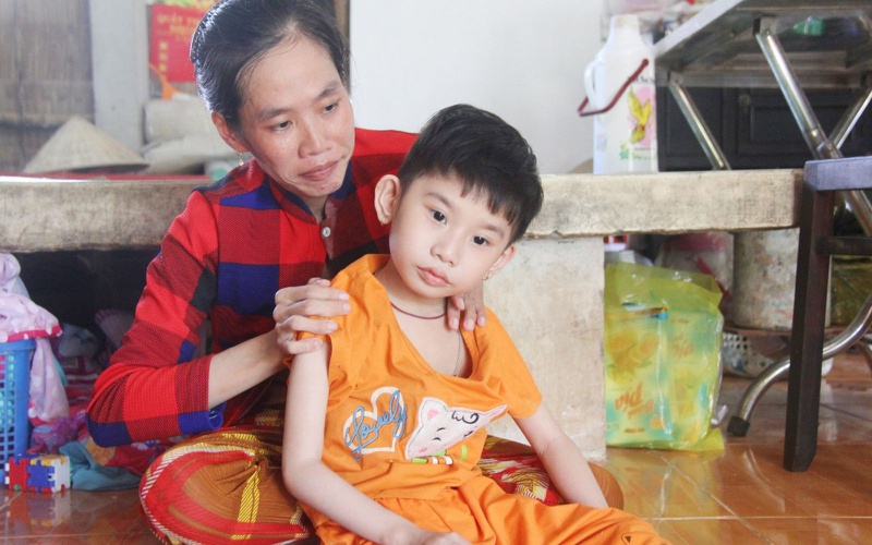Những điều cần biết về bệnh bại não ở trẻ em 2