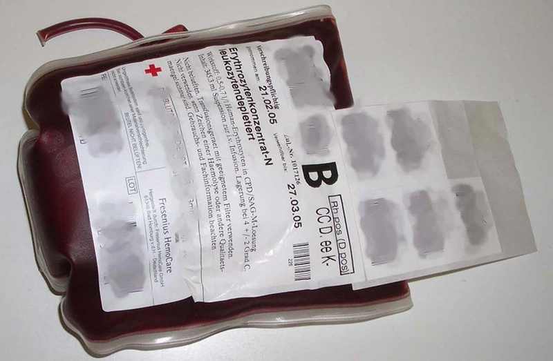 Các nhóm máu ở người bao gồm nhóm máu AB