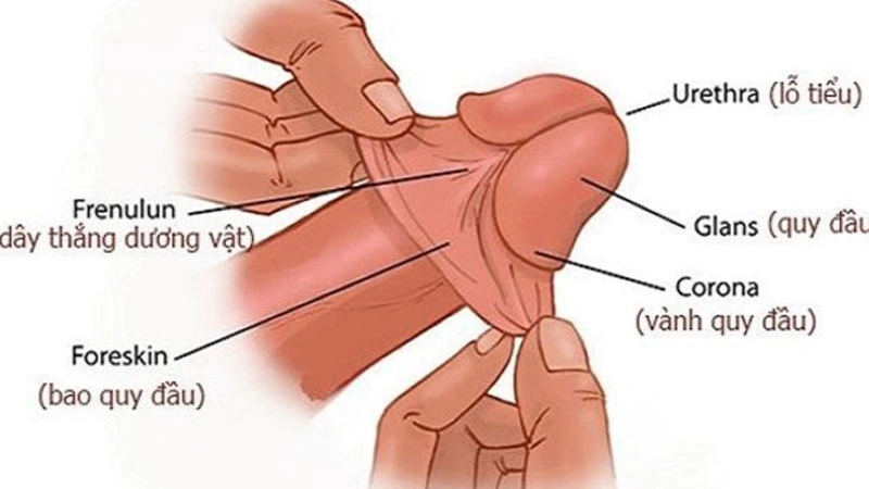 Những điều cần biết về đứt dây hãm bao quy đầu