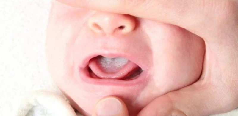 Những điều cần biết về hiện tượng bé chóp chép miệng khi ngủ 2