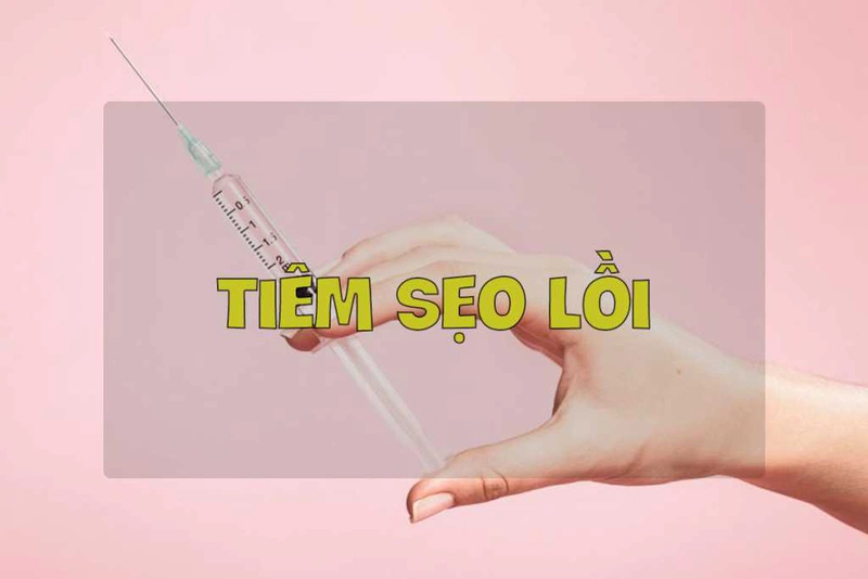 Những điều cần biết về sẹo lồi màu đỏ 3