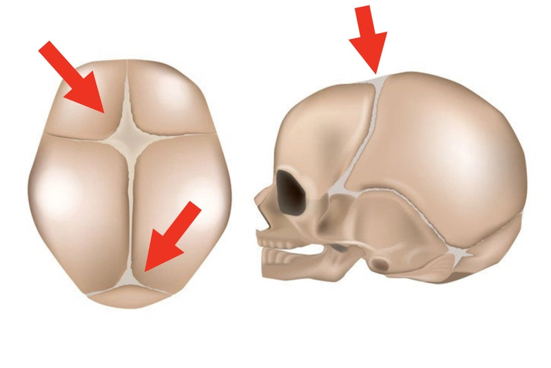 Những điều cần biết về thóp trẻ sơ sinh 2