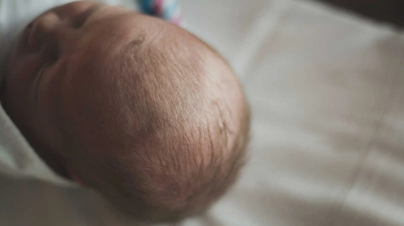Những điều cần biết về thóp trẻ sơ sinh 3