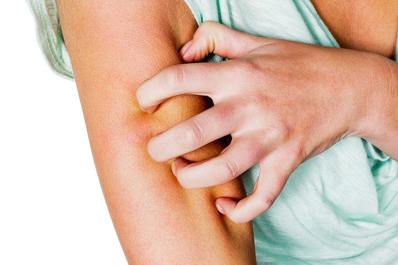 Những điều cần biết về thuốc dị ứng zyzocete