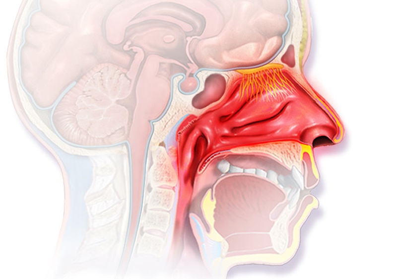 Những điều cần biết về viêm VA cấp ở trẻ? 1