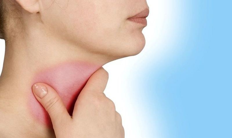 Những điều cần chú ý khi viêm họng ra nhiều đờm1