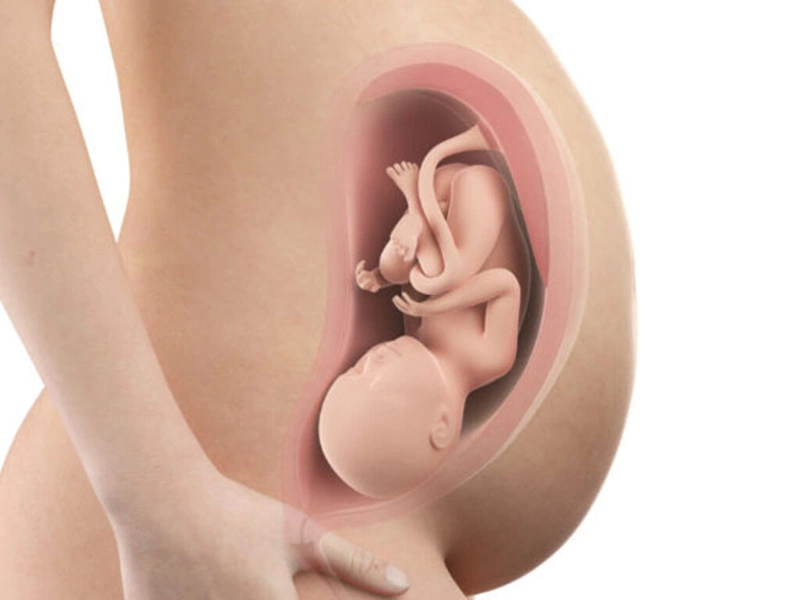 Những điều quan trọng thai phụ cần biết về khâu vòng cổ tử cung 4