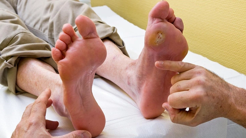 Những đối tượng nào dễ bị loét tì đè ở người cao tuổi? 1