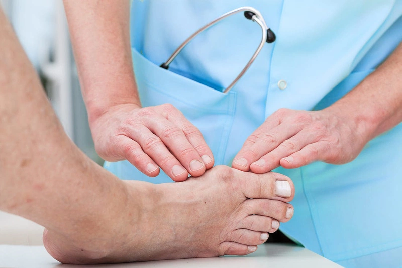 Những loại thuốc gout của Úc nổi tiếng trên thị trường hiện nay 3