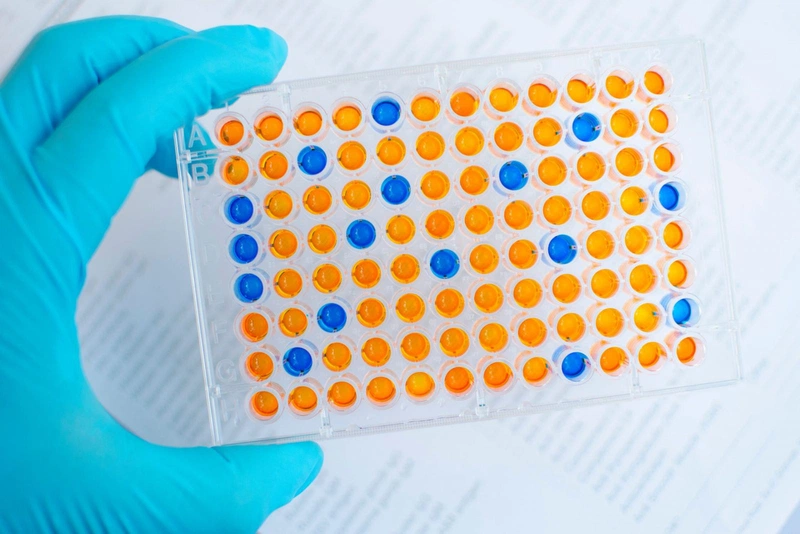 Những thông tin cần biết về xét nghiệm elisa HIV 1