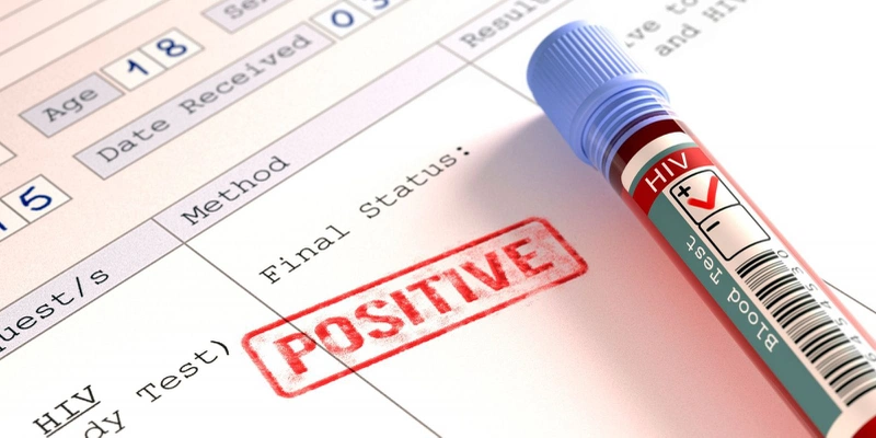 Những thông tin cần biết về xét nghiệm elisa HIV 5
