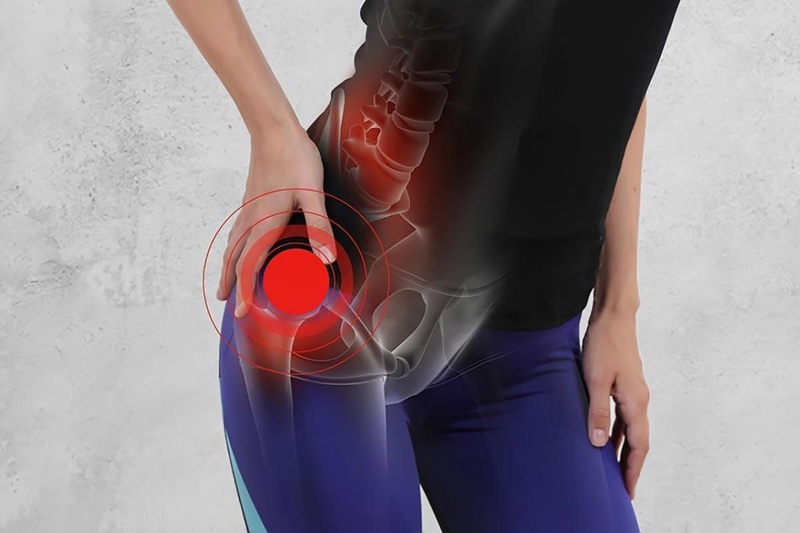 Những thông tin về chứng viêm khớp háng bên trái2