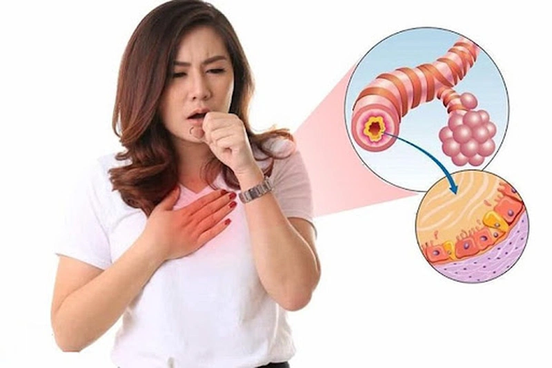 Những Yếu Tố Giúp Phân Biệt Viêm Phế Quản Phổi Và Viêm Tiểu Phế Quản  1