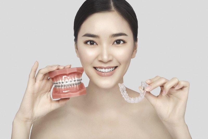 Niềng răng có làm môi bớt dày? Còn có cách khắc phục nào khác không? 2