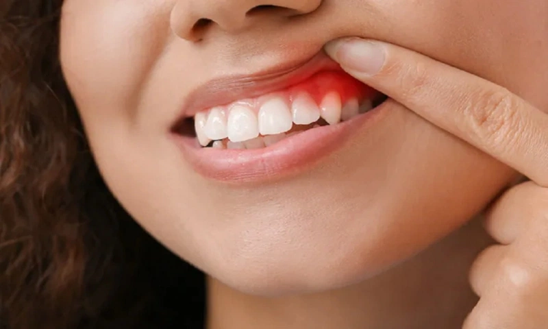 Niềng răng có làm răng dài ra không? Cách làm dài răng phổ biến? 2