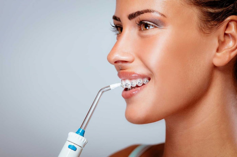 Niềng răng mất bao lâu thì tháo niềng được 3