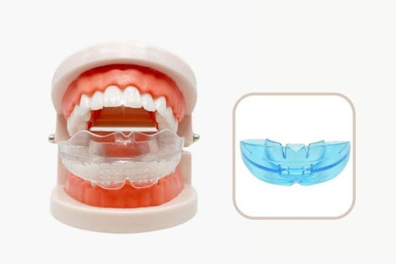 Những Chia Sẻ Về Niềng Răng Trainer