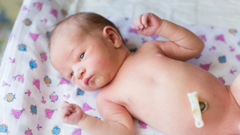 Thông tin từ A đến Z về nang niệu rốn ở trẻ sơ sinh 1