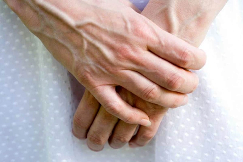Nổi gân xanh ở tay khi mang bầu có nguy hiểm không và khắc phục như thế nào? 1