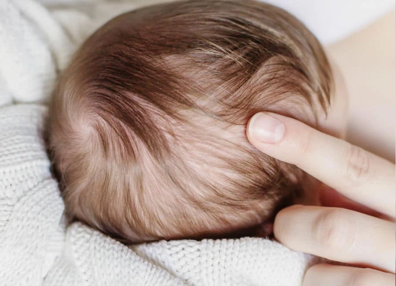 Nổi hạch sau đầu ở trẻ em: Nguyên nhân và cách xử lý 1