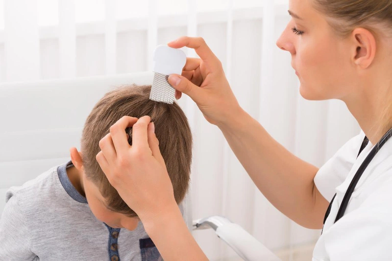 Nổi hạch sau gáy ở trẻ có nguy hiểm không? Xử lý thế nào? 2