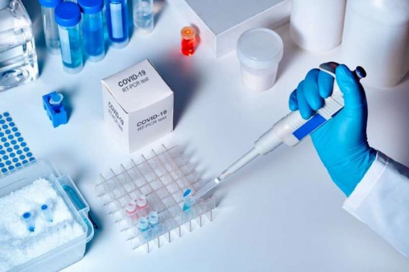Chỉ số CT Covid có ý nghĩa gì? Nồng độ virus Covid bao nhiêu là cao? 1