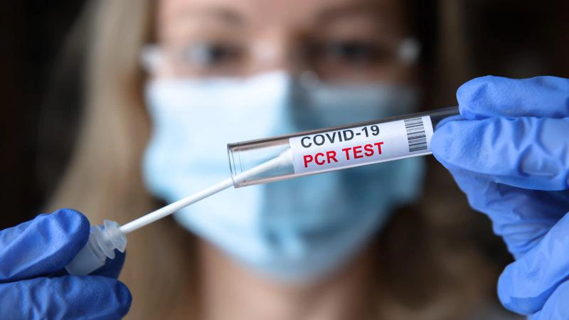 Chỉ số CT Covid có ý nghĩa gì? Nồng độ virus Covid bao nhiêu là cao? 3
