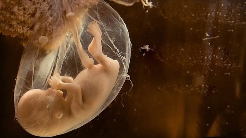 Nước ối có màu gì bất thường và những điều mẹ bầu nên biết 1