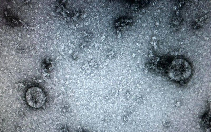 Nuôi cấy và phân lập thành công virus Corona tại Việt Nam