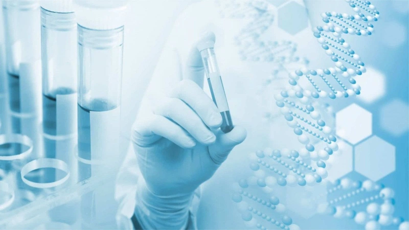 Xét nghiệm PCR lao