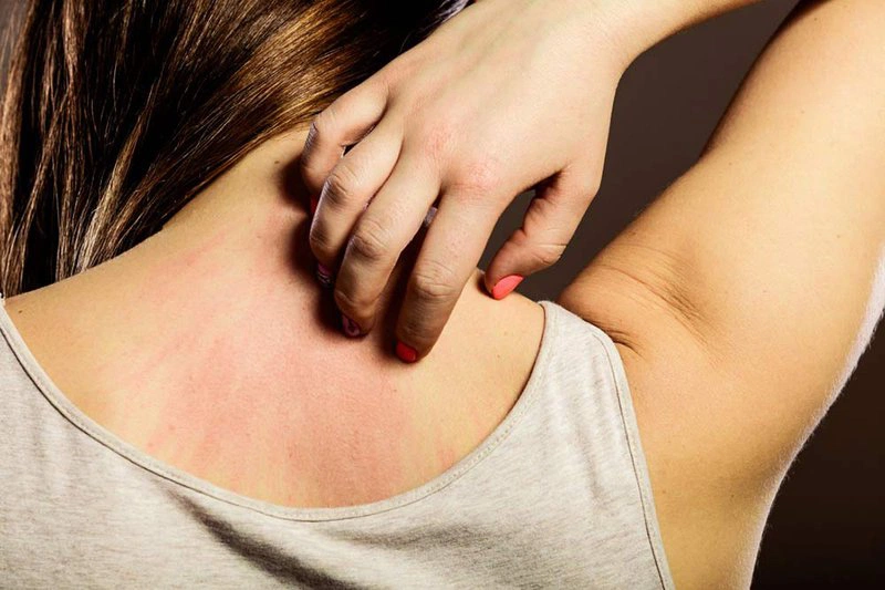 Phải làm gì khi bị ứ mật thai kỳ? 2