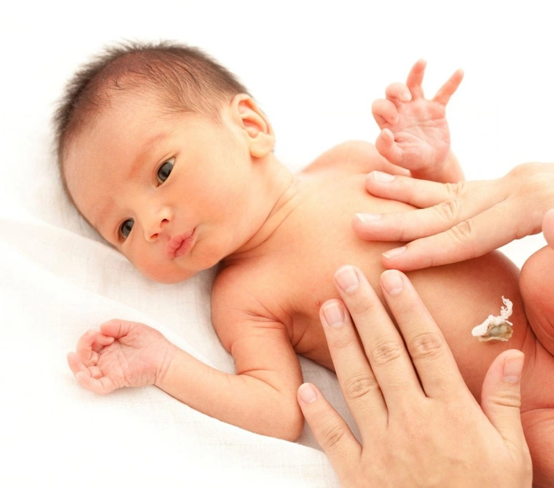 Mẹ không nên nôn nóng khi rốn bé không rụng vào thời điểm dự tính