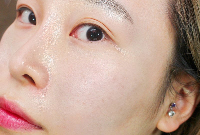 Phân biệt những loại da và cách chăm sóc phù hợp 4