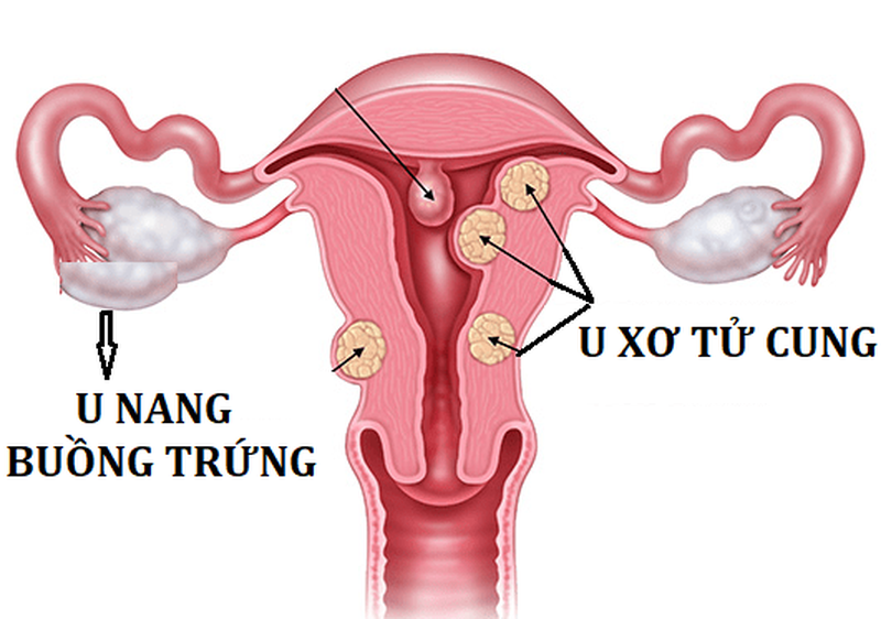 Uống Nga Phụ Khang có nóng không? 1
