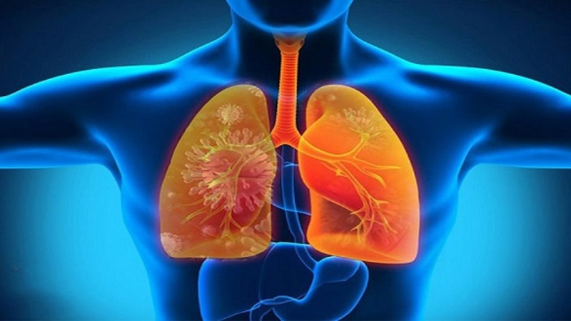 Cách phân biệt viêm phế quản và viêm phổi 1