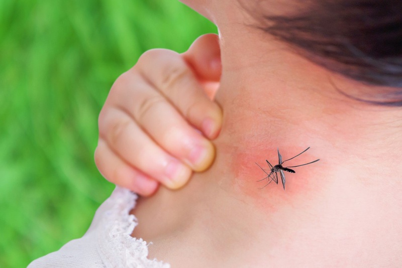 Phát ban sốt xuất huyết bao lâu thì khỏi?1