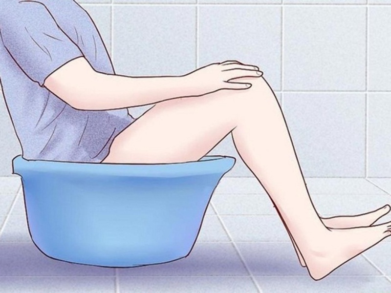 Phẫu thuật apxe hậu môn là gì? 4