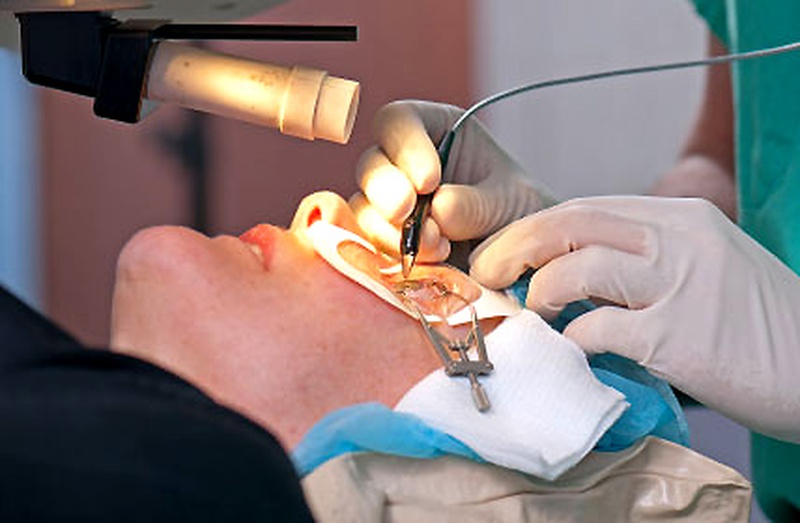 Bị loạn thị có đi nghĩa vụ quân sự không?4
