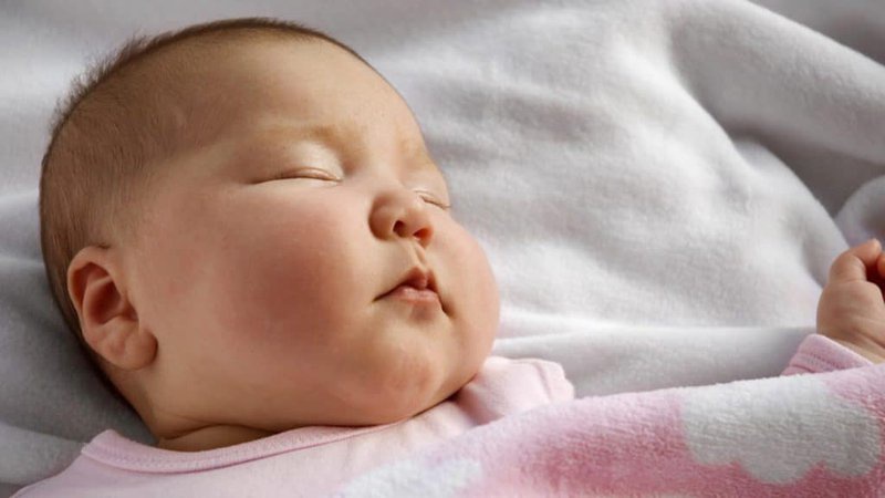 Mềm sụn thanh quản là một trong những bệnh lý bẩm sinh