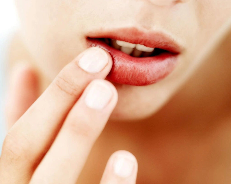 Phẫu thuật môi dày thành mỏng như thế nào? 2