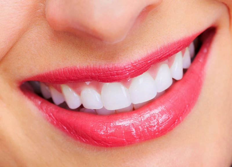Phẫu thuật răng hô và cách chăm sóc sau phẫu thuật 2