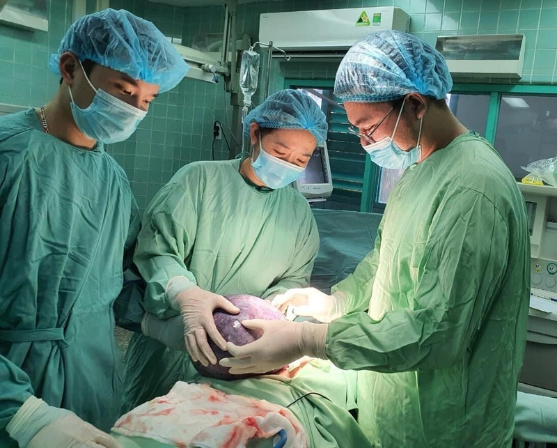 Phẫu thuật u nang buồng trứng và những điều cần biết 4