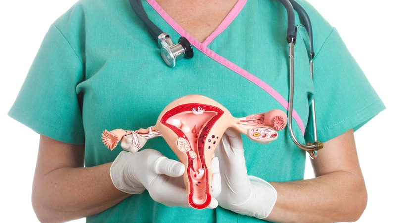 Phẫu thuật u nang buồng trứng và những điều cần biết 5