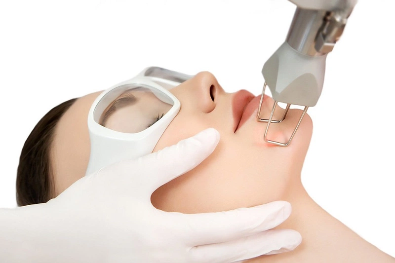 Phẫu thuật xóa sẹo trắng: Ưu điểm và lưu ý 2