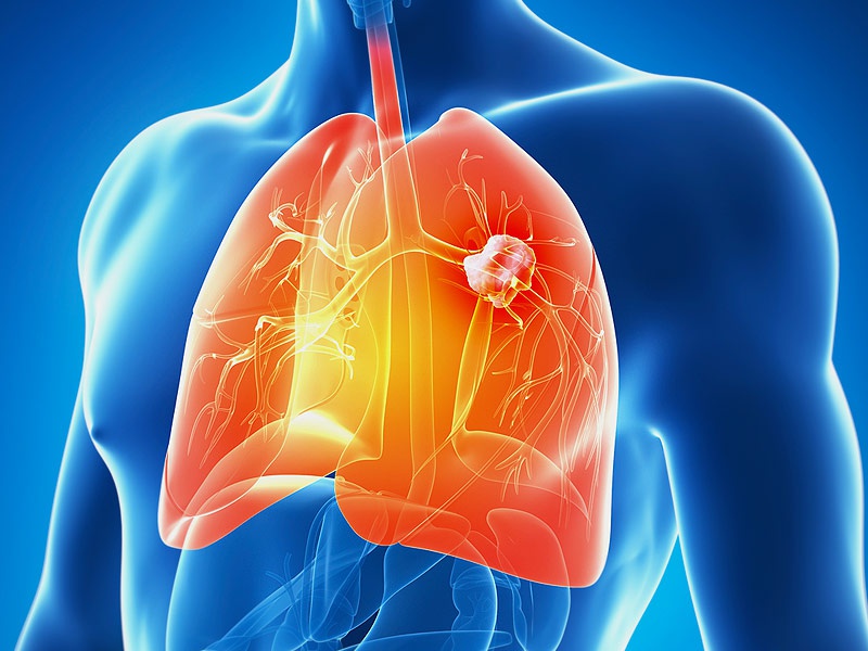 Cách bảo vệ hệ hô hấp để lá phổi luôn được khỏe mạnh1