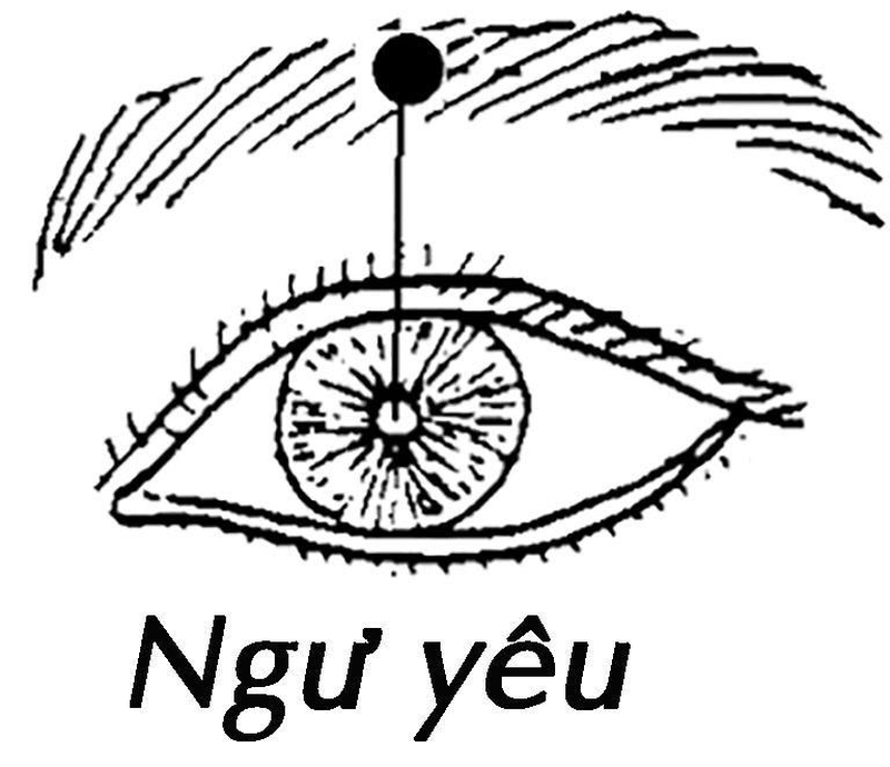 Phối hợp huyệt Ngư Yêu cùng huyệt đạo khác để chữa bệnh hiệu quả 1