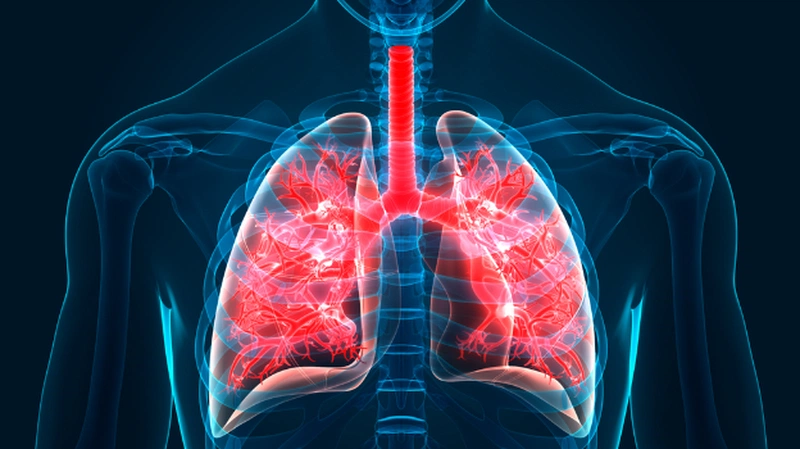 Xơ phổi sau lao ảnh hưởng như thế nào đến sức khỏe người bệnh? 1