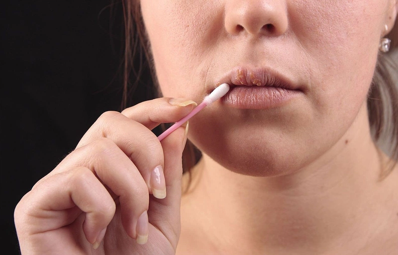 Phun môi 2 ngày đã bong là do đâu? Có ảnh hưởng đến màu môi không? 1