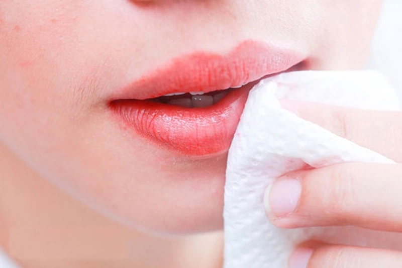 Kiêng nước 100% để tránh vi khuẩn bám vào môi
